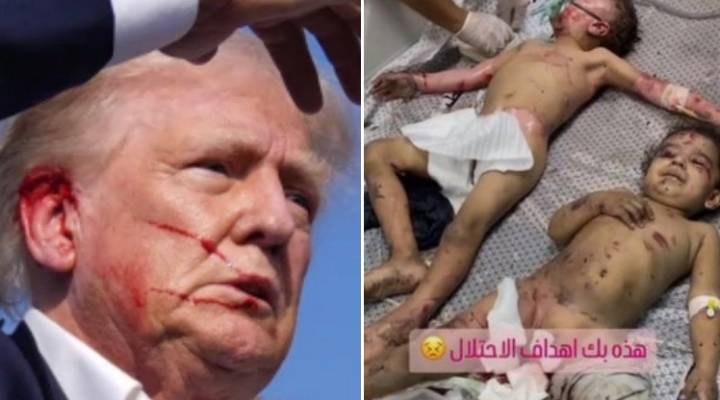 Поцарапанное ухо Трампа и палестинские дети